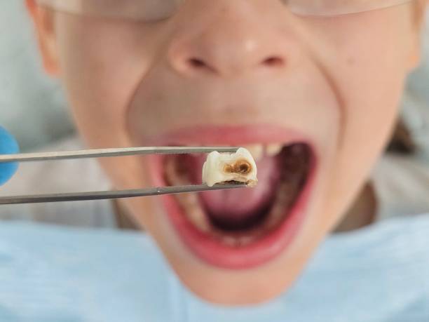 Best Pediatric Emergency Dentist in Level Green, PA